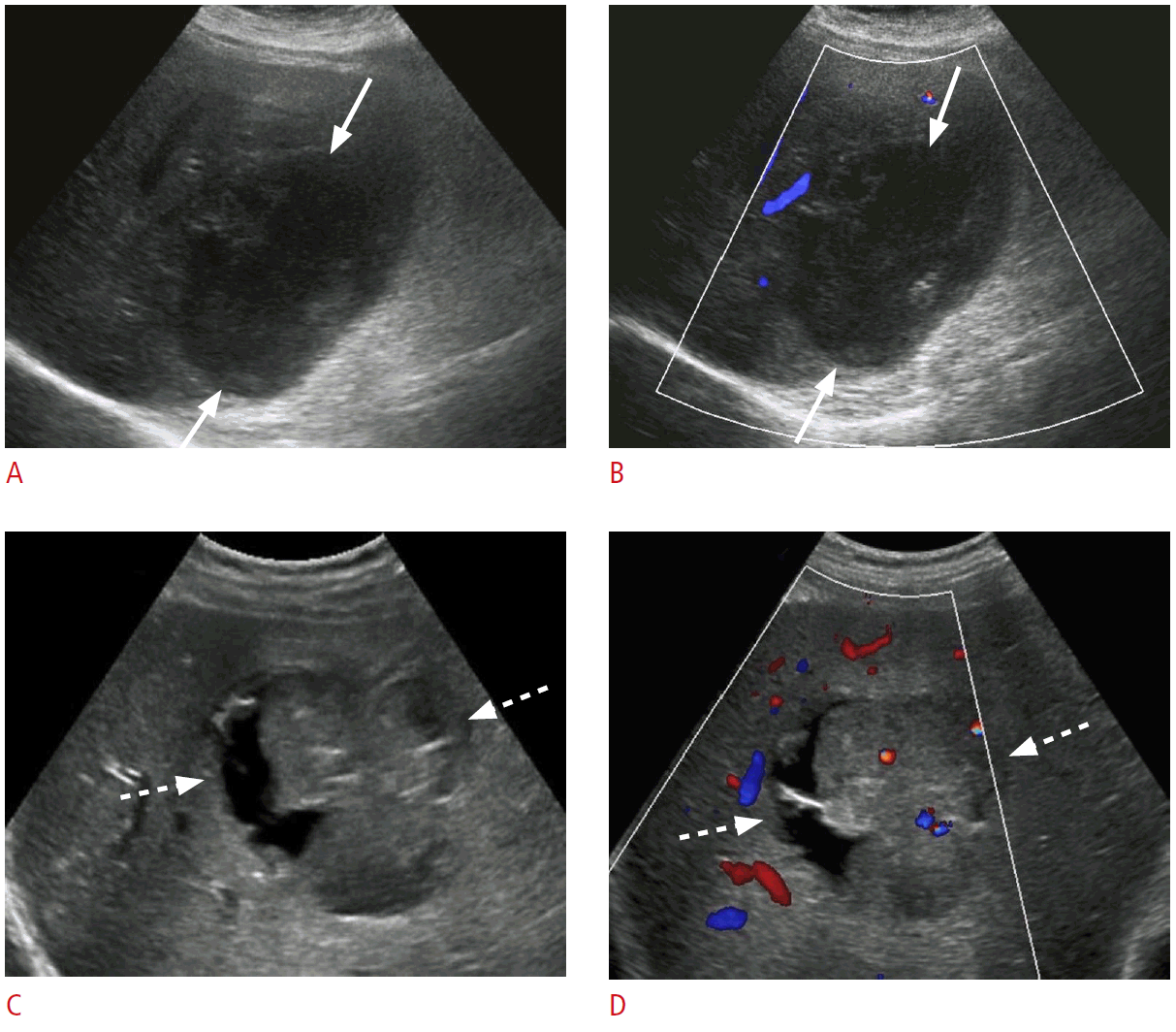 Ultrasonographic evaluation of patients with abnormal liver function ...